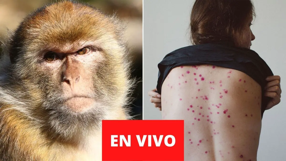 Viruela del mono Perú 2022 EN VIVO: últimas noticias de HOY mujeres embarazadas y niños en riesgo ¿hay casos confirmados?