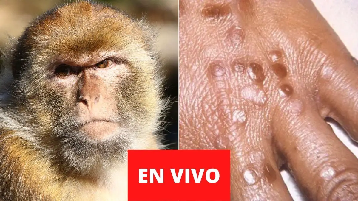 Virus del mono EN VIVO HOY 2022: síntomas, cómo se contagia el nuevo virus y noticias de última hora