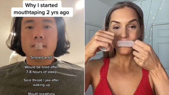 vendajes bucales tiktok