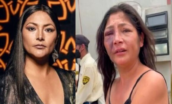 Magaly Solier aparece con rostro desfigurado: ¿Qué le pasó?