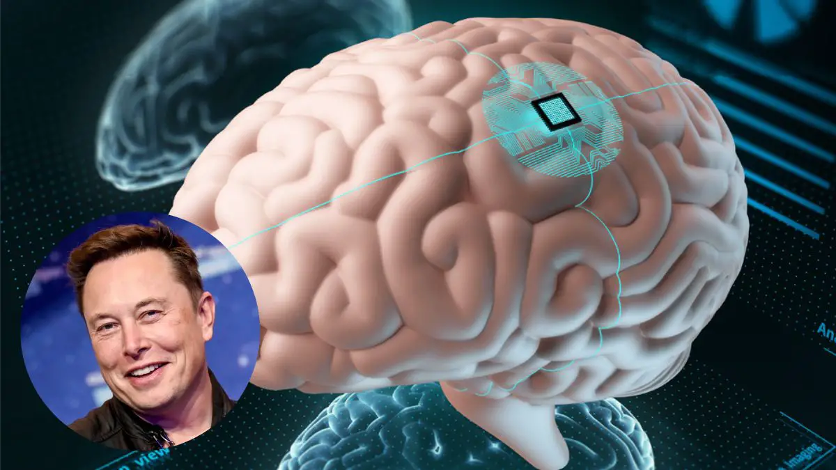 Neuralink De Elon Musk Ya Tiene Permiso Para Probar Chips Cerebrales En Humanos