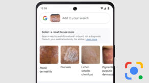 Google Lens problemas piel dermatología